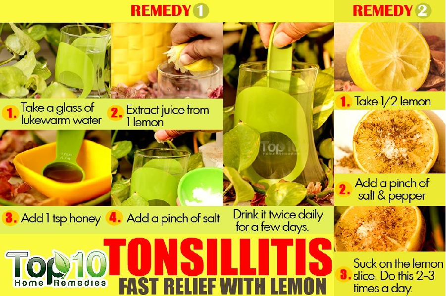 Natural remedies for treating tonsils at home