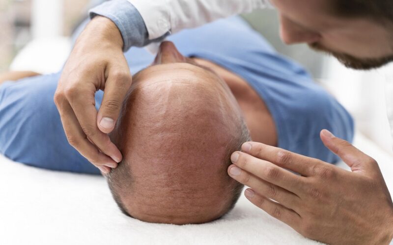 Hair Transplants